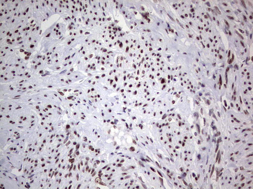 HDAC9 Antibody - Immunohistochemical staining of paraffin-embedded Human endometrium tissue within the normal limits using anti-HDAC9 mouse monoclonal antibody. (Heat-induced epitope retrieval by 1 mM EDTA in 10mM Tris, pH8.5, 120C for 3min,