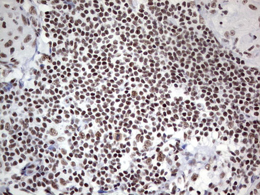 HDAC9 Antibody - Immunohistochemical staining of paraffin-embedded Human lymph node tissue within the normal limits using anti-HDAC9 mouse monoclonal antibody. (Heat-induced epitope retrieval by 1 mM EDTA in 10mM Tris, pH8.5, 120C for 3min,