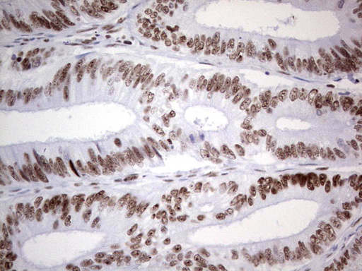 HDAC9 Antibody - Immunohistochemical staining of paraffin-embedded Human colon tissue within the normal limits using anti-HDAC9 mouse monoclonal antibody. (Heat-induced epitope retrieval by 1 mM EDTA in 10mM Tris, pH8.5, 120C for 3min,