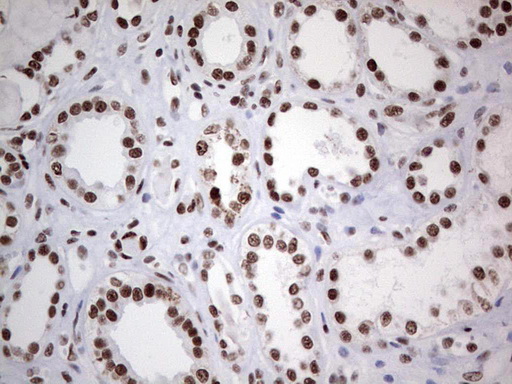 HDAC9 Antibody - Immunohistochemical staining of paraffin-embedded Human Kidney tissue within the normal limits using anti-HDAC9 mouse monoclonal antibody. (Heat-induced epitope retrieval by 1 mM EDTA in 10mM Tris, pH8.5, 120C for 3min,