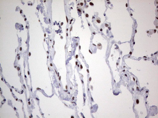 HDAC9 Antibody - Immunohistochemical staining of paraffin-embedded Human lung tissue within the normal limits using anti-HDAC9 mouse monoclonal antibody. (Heat-induced epitope retrieval by 1 mM EDTA in 10mM Tris, pH8.5, 120C for 3min,