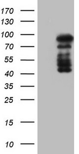 HDAC9 Antibody - HEK293T cells were transfected with the pCMV6-ENTRY control (Left lane) or pCMV6-ENTRY HDAC9 (Right lane) cDNA for 48 hrs and lysed. Equivalent amounts of cell lysates (5 ug per lane) were separated by SDS-PAGE and immunoblotted with anti-HDAC9.