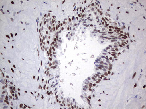 HDAC9 Antibody - IHC of paraffin-embedded Human prostate tissue using anti-HDAC9 mouse monoclonal antibody. (Heat-induced epitope retrieval by 1 mM EDTA in 10mM Tris, pH8.5, 120°C for 3min).