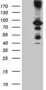 HDAC9 Antibody - HEK293T cells were transfected with the pCMV6-ENTRY control. (Left lane) or pCMV6-ENTRY HDAC9. (Right lane) cDNA for 48 hrs and lysed. Equivalent amounts of cell lysates. (5 ug per lane) were separated by SDS-PAGE and immunoblotted with anti-HDAC9. (1:2000)