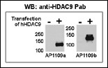 HDAC9 Antibody - Both anti-HDAC9 N-term and C-term antibody were tested by WB and IP-WB using HeLa and HeLa-HDAC9 transfected cells. Top figure shows both antibody specifically detect HDAC9 in HeLa-HDAC9 transfected cell but not HeLa alone.