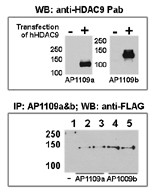HDAC9 Antibody - Both anti-HDAC9 N-term (AP1109a) and C-term antibody were tested by WB and IP-WB using HeLa and HeLa-HDAC9 transfected cells. Top figure shows both antibody specifically detect HDAC9 in HeLa-HDAC9 transfected cell but not HeLa alone. Bottom figure shows that both antibody can immunoprecipitate (IP) HDAC9 from HeLa-HDAC9 transfected cells. (Data kindly provided by Dr. Zhigang Yuan, H. Lee Moffitt Cancer Center and Research Institute, Tampa, FL).