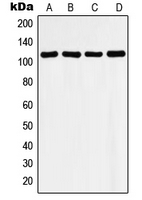 HDAC9 Antibody - Western blot analysis of Histone Deacetylase 9 expression in LO2 (A); mouse heart (B); rat heart (C); Ramos (D) whole cell lysates.