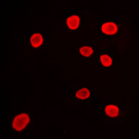 HDAC9 Antibody - Immunofluorescent analysis of Histone Deacetylase 9 staining in Ramos cells. Formalin-fixed cells were permeabilized with 0.1% Triton X-100 in TBS for 5-10 minutes and blocked with 3% BSA-PBS for 30 minutes at room temperature. Cells were probed with the primary antibody in 3% BSA-PBS and incubated overnight at 4 C in a humidified chamber. Cells were washed with PBST and incubated with a DyLight 594-conjugated secondary antibody (red) in PBS at room temperature in the dark. DAPI was used to stain the cell nuclei (blue).