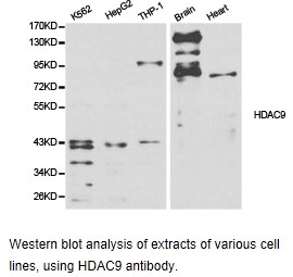 HDAC9 Antibody - Western blot.