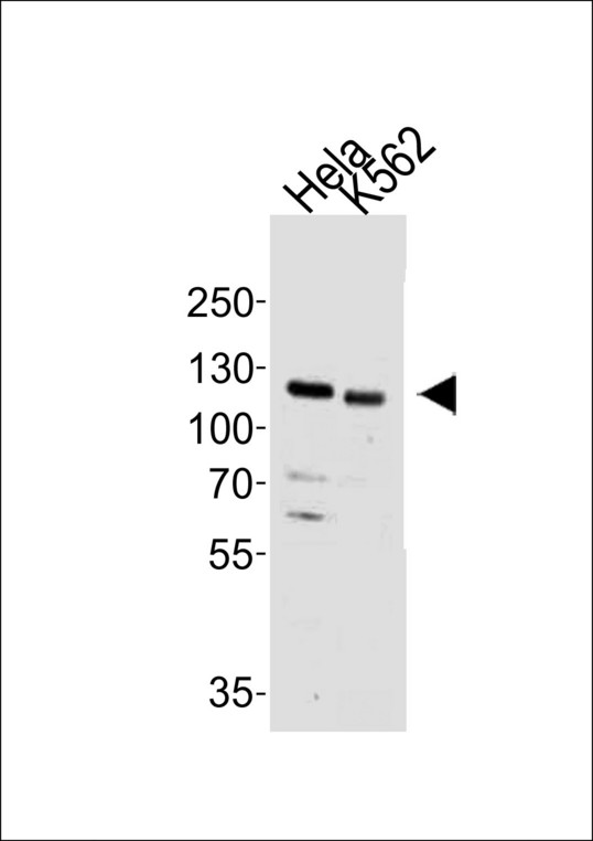 HDAC9 Antibody - Western blot of lysates from HeLa,K562 cell line (from left to right), using HDAC9 Antibody(A1-0639). A1-0639 was diluted at 1:500 at each lane. A goat anti-rabbit IgG H&L (HRP) at 1:10000 dilution was used as the secondary antibody.Lysates at 20 ug per lane.