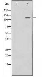 HDAC9 Antibody - Western blot of HDAC9 expression in HepG2 whole cell lysates,The lane on the left is treated with the antigen-specific peptide.