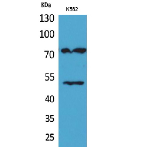 HDC / Histidine Decarboxylase Antibody - Western blot of HDC antibody