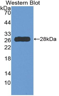 HDC / Histidine Decarboxylase Antibody - Western blot of recombinant HDC / Histidine Decarboxylase.