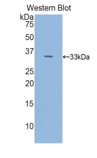 HDC / Histidine Decarboxylase Antibody - Western blot of recombinant HDC / Histidine Decarboxylase.  This image was taken for the unconjugated form of this product. Other forms have not been tested.