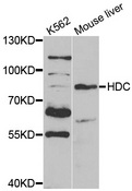 HDC / Histidine Decarboxylase Antibody - Western blot analysis of extracts of mouse liver.