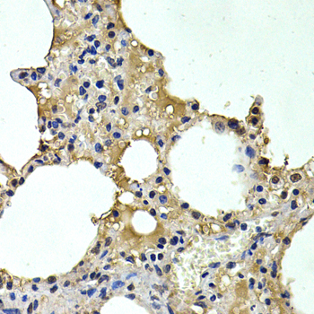 HDC / Histidine Decarboxylase Antibody - Immunohistochemistry of paraffin-embedded rat lung tissue.