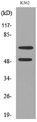 HDC / Histidine Decarboxylase Antibody - Western blot analysis of lysate from K562 cells, using HDC Antibody.