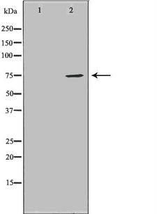 HDC / Histidine Decarboxylase Antibody - Western blot analysis of extracts of mouse liver tissue using HDC antibody. The lane on the left is treated with the antigen-specific peptide.