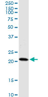 HDDC3 Antibody - HDDC3 monoclonal antibody (M05), clone 7E6. Western blot of HDDC3 expression in MCF-7.
