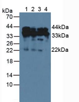 HDGF Antibody - Western Blot; Sample: Lane1: Human Hela Cells; Lane2: Human A549 Cells; Lane3: Human Jurkat Cells; Lane4: Human 293T Cells.