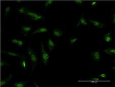HDGF Antibody - Immunofluorescence of monoclonal antibody to HDGF on HeLa cell . [antibody concentration 10 ug/ml]