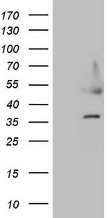 HDGF Antibody - HEK293T cells were transfected with the pCMV6-ENTRY control. (Left lane) or pCMV6-ENTRY HDGF. (Right lane) cDNA for 48 hrs and lysed. Equivalent amounts of cell lysates. (5 ug per lane) were separated by SDS-PAGE and immunoblotted with anti-HDGF. (1:500)