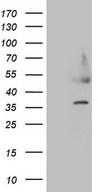 HDGF Antibody - HEK293T cells were transfected with the pCMV6-ENTRY control. (Left lane) or pCMV6-ENTRY HDGF. (Right lane) cDNA for 48 hrs and lysed. Equivalent amounts of cell lysates. (5 ug per lane) were separated by SDS-PAGE and immunoblotted with anti-HDGF. (1:500)