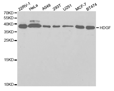 HDGF Antibody - Western blot analysis of extracts of various cell lines.