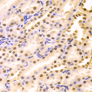 HDGF Antibody - Immunohistochemistry of paraffin-embedded rat kidney tissue.