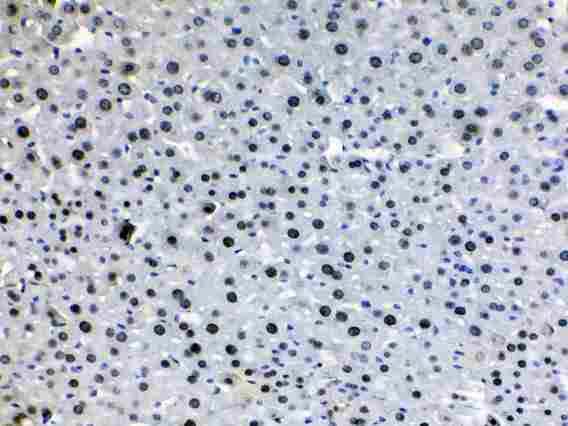 HDGF Antibody - HDGF was detected in paraffin-embedded sections of mouse liver tissues using rabbit anti-HDGF Antigen Affinity purified polyclonal antibody at 1 µg/mL. The immunohistochemical section was developed using SABC method