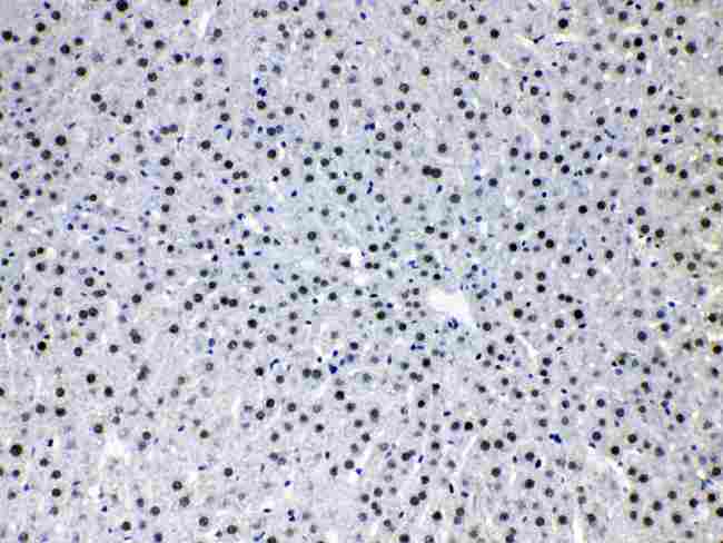 HDGF Antibody - HDGF was detected in paraffin-embedded sections of rat liver tissues using rabbit anti-HDGF Antigen Affinity purified polyclonal antibody at 1 µg/mL. The immunohistochemical section was developed using SABC method