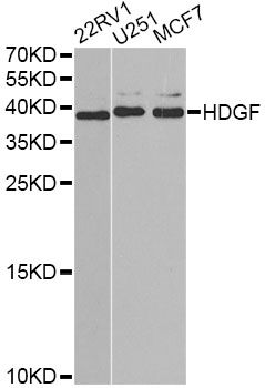 HDGF Antibody - Western blot analysis of extracts of various cell lines, using HDGF antibody at 1:1000 dilution. The secondary antibody used was an HRP Goat Anti-Rabbit IgG (H+L) at 1:10000 dilution. Lysates were loaded 25ug per lane and 3% nonfat dry milk in TBST was used for blocking. An ECL Kit was used for detection and the exposure time was 90s.