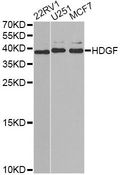 HDGF Antibody - Western blot analysis of extracts of various cell lines, using HDGF antibody at 1:1000 dilution. The secondary antibody used was an HRP Goat Anti-Rabbit IgG (H+L) at 1:10000 dilution. Lysates were loaded 25ug per lane and 3% nonfat dry milk in TBST was used for blocking. An ECL Kit was used for detection and the exposure time was 90s.