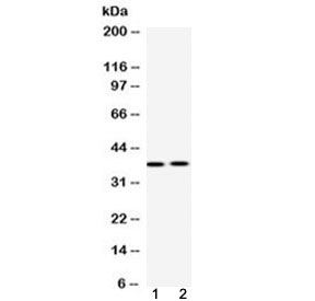 HDGF Antibody - Western blot testing of 1) rat liver and 2) human 22RV1 (prostate carcinoma) lysate with HDGF antibody at 0.5ug/ml. Predicted molecular weight ~26 kDa but routinely observed at ~38 kDa.