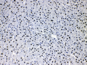 HDGF Antibody - IHC testing of FFPE rat liver tissue with HDGF antibody at 1ug/ml. HIER: steam section in pH6 citrate buffer for 20 min.
