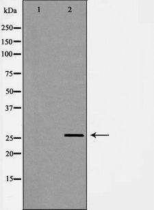 HDGF Antibody - Western blot analysis of HeLa whole cells lysates using HDGF antibody. The lane on the left is treated with the antigen-specific peptide.