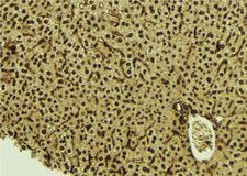 HDGF Antibody - 1:100 staining mouse liver tissue by IHC-P. The sample was formaldehyde fixed and a heat mediated antigen retrieval step in citrate buffer was performed. The sample was then blocked and incubated with the antibody for 1.5 hours at 22°C. An HRP conjugated goat anti-rabbit antibody was used as the secondary.