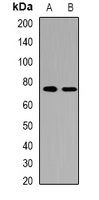 HDGFRP2 Antibody - Western blot analysis of HRP2 expression in HepG2 (A); HeLa (B) whole cell lysates.