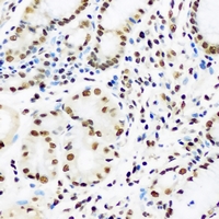 HDGFRP2 Antibody - Immunohistochemical analysis of HRP2 staining in human stomach formalin fixed paraffin embedded tissue section. The section was pre-treated using heat mediated antigen retrieval with sodium citrate buffer (pH 6.0). The section was then incubated with the antibody at room temperature and detected using an HRP conjugated compact polymer system. DAB was used as the chromogen. The section was then counterstained with hematoxylin and mounted with DPX.