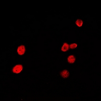 HDGFRP2 Antibody - Immunofluorescent analysis of HRP2 staining in A549 cells. Formalin-fixed cells were permeabilized with 0.1% Triton X-100 in TBS for 5-10 minutes and blocked with 3% BSA-PBS for 30 minutes at room temperature. Cells were probed with the primary antibody in 3% BSA-PBS and incubated overnight at 4 deg C in a humidified chamber. Cells were washed with PBST and incubated with a DyLight 594-conjugated secondary antibody (red) in PBS at room temperature in the dark.