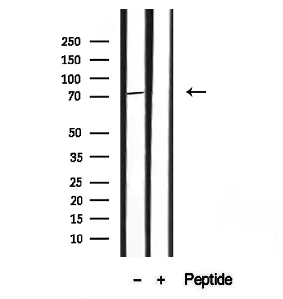 HDGFRP2 Antibody - Western blot analysis of extracts of HepG2 cells using HRP2 antibody.