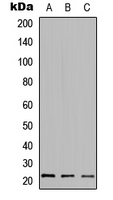 HDGFRP3 Antibody - Western blot analysis of HDGFRP3 expression in A549 (A); Raw264.7 (B); PC12 (C) whole cell lysates.
