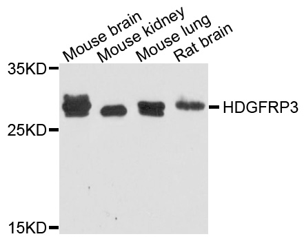 HDGFRP3 Antibody - Western blot analysis of extract of various cells.