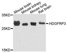 HDGFRP3 Antibody - Western blot analysis of extract of various cells.