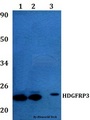 HDGFRP3 Antibody - Western blot of HDGFRP3 antibody at 1:500 dilution Line1:A549 whole cell lysate Line2:H9C2 whole cell lysate Line3:Raw264.7 whole cell lysate.
