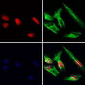 HDGFRP3 Antibody - Staining HeLa cells by IF/ICC. The samples were fixed with PFA and permeabilized in 0.1% Triton X-100, then blocked in 10% serum for 45 min at 25°C. Samples were then incubated with primary Ab(1:200) and mouse anti-beta tubulin Ab(1:200) for 1 hour at 37°C. An AlexaFluor594 conjugated goat anti-rabbit IgG(H+L) Ab(1:200 Red) and an AlexaFluor488 conjugated goat anti-mouse IgG(H+L) Ab(1:600 Green) were used as the secondary antibod