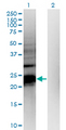 HDHD1 Antibody - Western Blot analysis of HDHD1A expression in transfected 293T cell line by HDHD1A monoclonal antibody (M05), clone 4F12.Lane 1: HDHD1A transfected lysate (Predicted MW: 23.7 KDa).Lane 2: Non-transfected lysate.