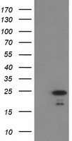 HDHD1 Antibody - HEK293T cells were transfected with the pCMV6-ENTRY control (Left lane) or pCMV6-ENTRY HDHD1A (Right lane) cDNA for 48 hrs and lysed. Equivalent amounts of cell lysates (5 ug per lane) were separated by SDS-PAGE and immunoblotted with anti-HDHD1A.