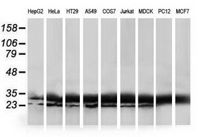 HDHD1 Antibody - Western blot of extracts (35 ug) from 9 different cell lines by using anti-HDHD1A monoclonal antibody.