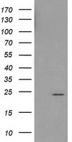 HDHD1 Antibody - HEK293T cells were transfected with the pCMV6-ENTRY control (Left lane) or pCMV6-ENTRY HDHD1A (Right lane) cDNA for 48 hrs and lysed. Equivalent amounts of cell lysates (5 ug per lane) were separated by SDS-PAGE and immunoblotted with anti-HDHD1A.
